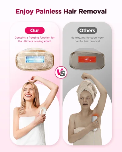 Laser Epilator – 990,000 Flashes IPL Hair Removal for Face, Body & Bikini - Image 5