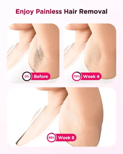 Laser Epilator – 990,000 Flashes IPL Hair Removal for Face, Body & Bikini - Image 6