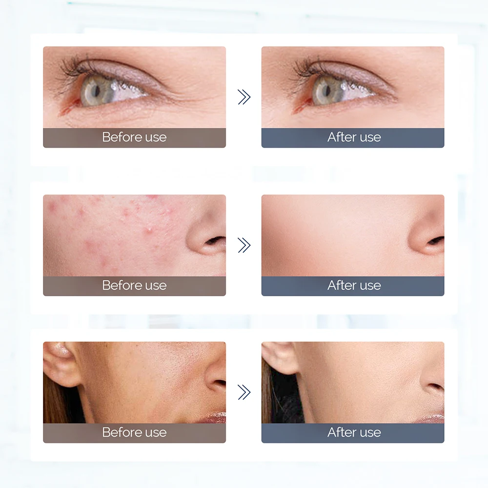 LED mask therapy light colors and skincare benefits